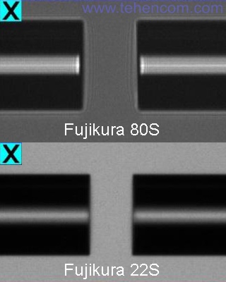 Сравнение детализации изображений аппарата с изменяемым фокусным расстоянием (Fujikura 80S) и фиксированным фокусным расстоянием (Fujikura 22S)