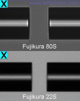 Порівняння деталізації зображень апарата зі змінною фокусною відстанню (Fujikura 80S) та фіксованою фокусною відстанню (Fujikura 22S)